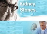 51 Kidney Stones Tips