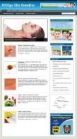 Vitiligo Niche Blog 