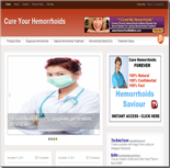 Hemorrhoids Niche Blog 